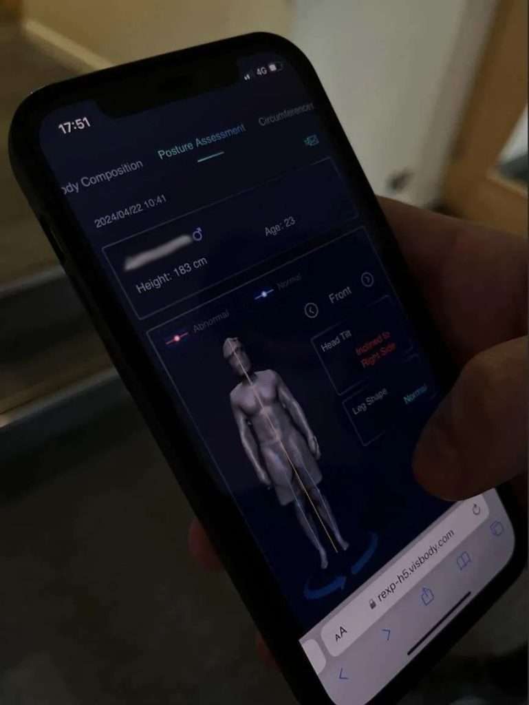 body scanner